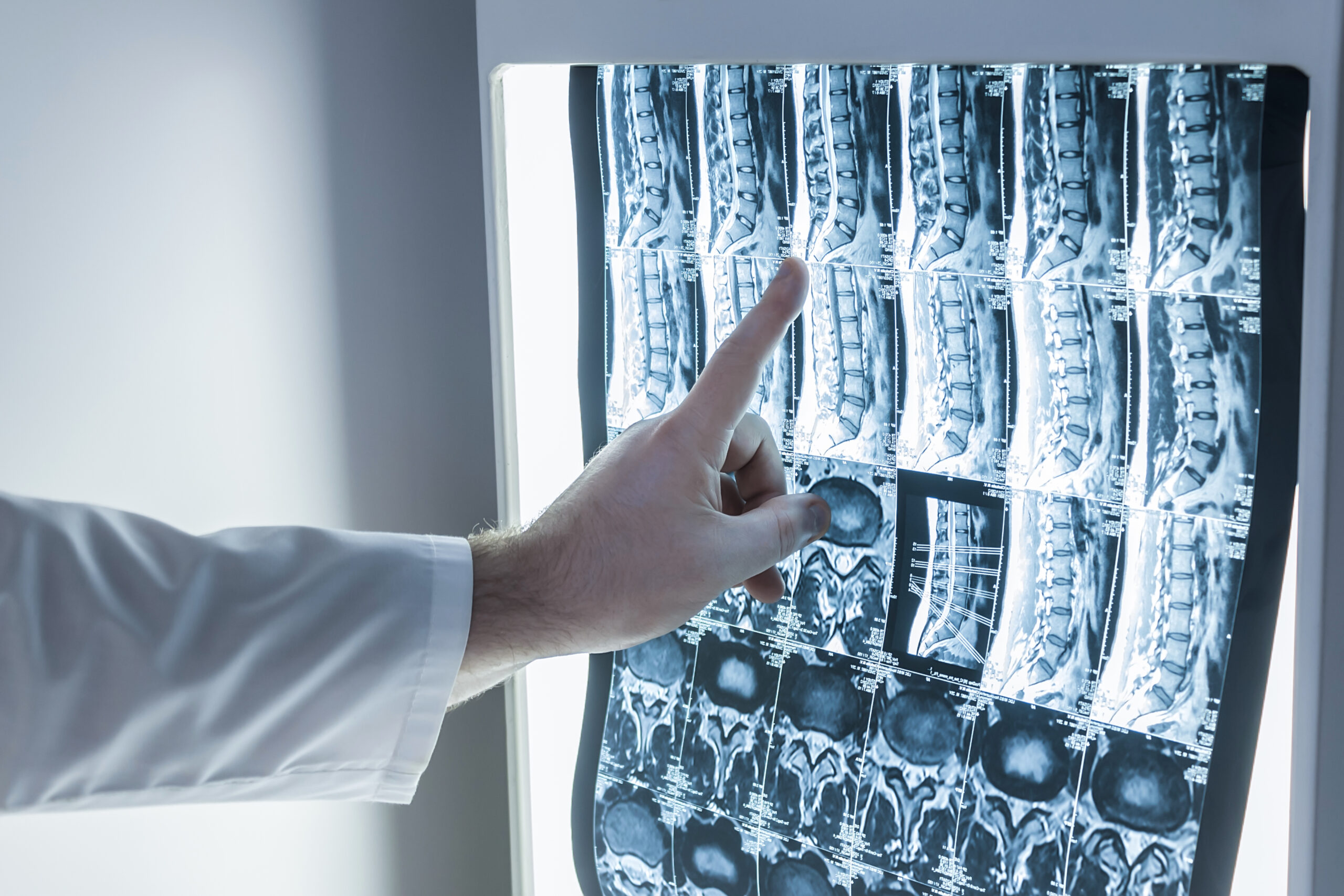 spinal-scan-using-magnetic-resonance-imaging-scanner-examined-by-surgeon